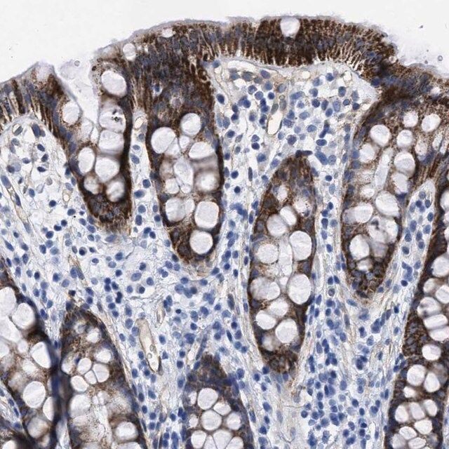 Anti-KCNMB3 antibody produced in rabbit