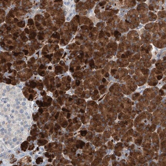 Anti-KCNK10 antibody produced in rabbit