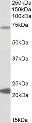 Anti-KCNN2 antibody produced in goat