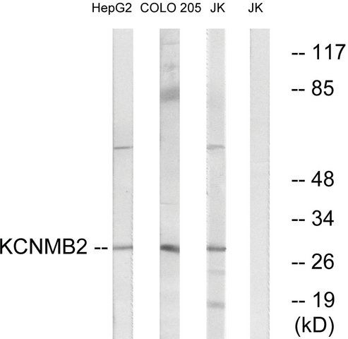 Anti-KCNMB2 antibody produced in rabbit