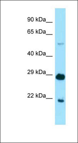 Anti-IKZF1 antibody produced in rabbit