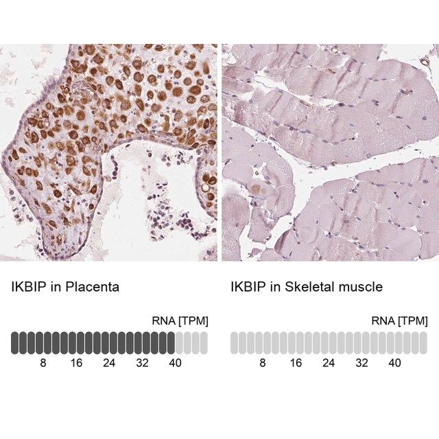 Anti-IKBIP antibody produced in rabbit