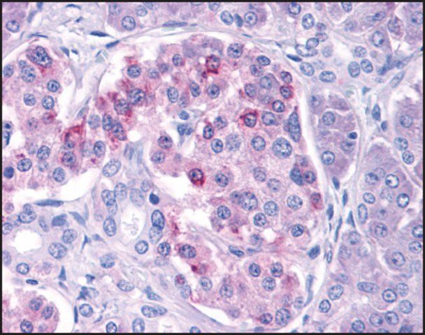 Anti-IKK antibody produced in rabbit