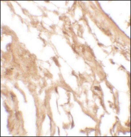 Anti-IL-37 antibody produced in rabbit