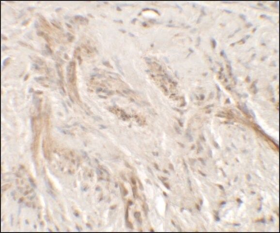 Anti-IL-36G antibody produced in rabbit