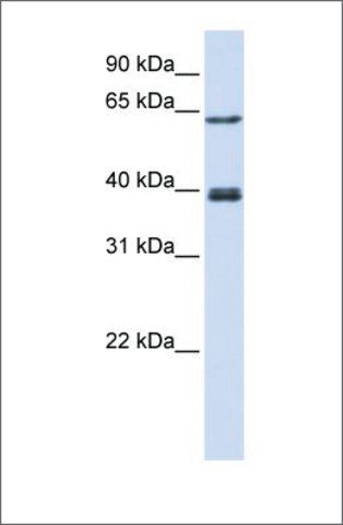 Anti-IKZF3 antibody produced in rabbit