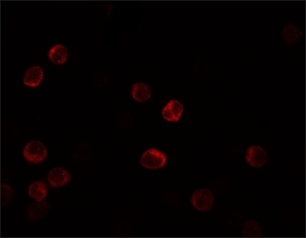 Anti-IL-28B antibody produced in rabbit