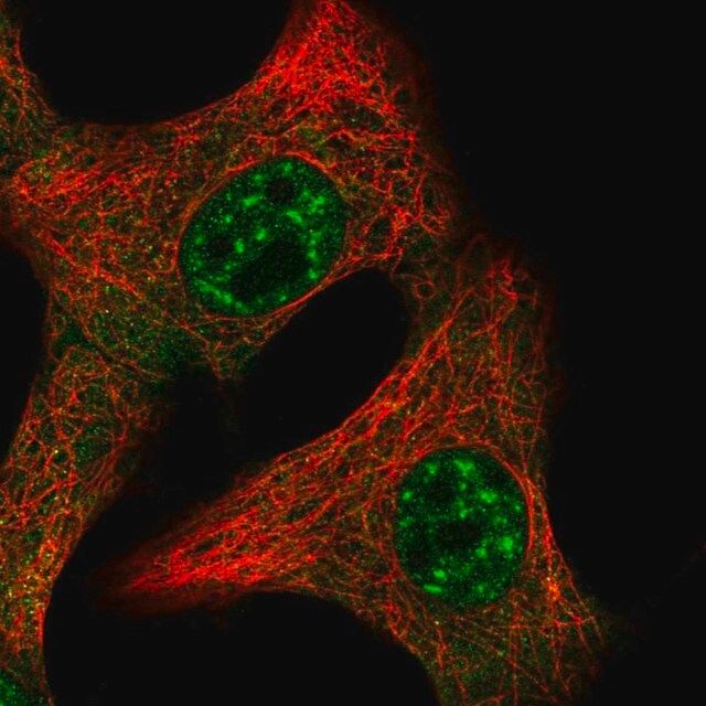 Anti-IL15 antibody produced in rabbit