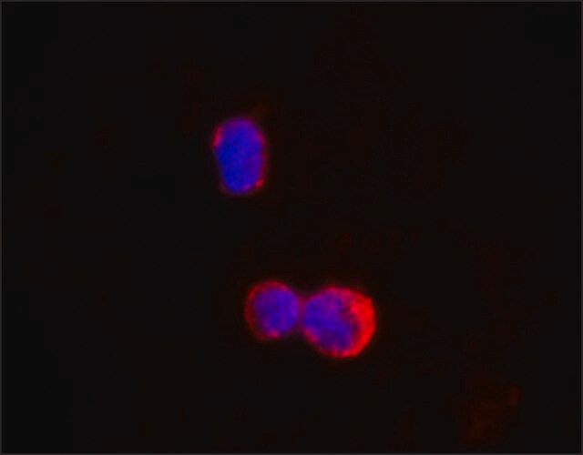 Anti-IKZF1/IKAROS antibody, Mouse monoclonal