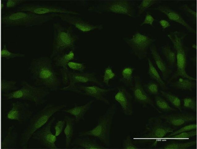 Anti-IKZF1 antibody produced in mouse