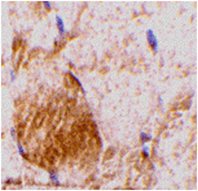 Anti-IL-31 Antibody