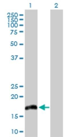 Anti-IL20 antibody produced in rabbit