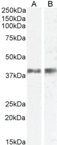 Anti-IL12B/IL12P40 (AB2) antibody produced in goat