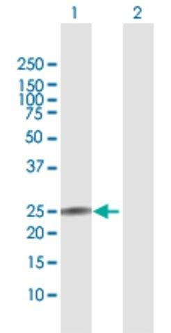 Anti-IL22 antibody produced in rabbit