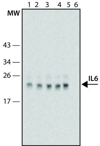 Anti-IL6 high affinity antibody, Mouse monoclonal