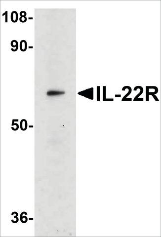 Anti-IL-22 Receptor antibody produced in rabbit