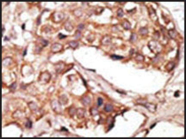 Anti-IL-27 (center) antibody produced in rabbit