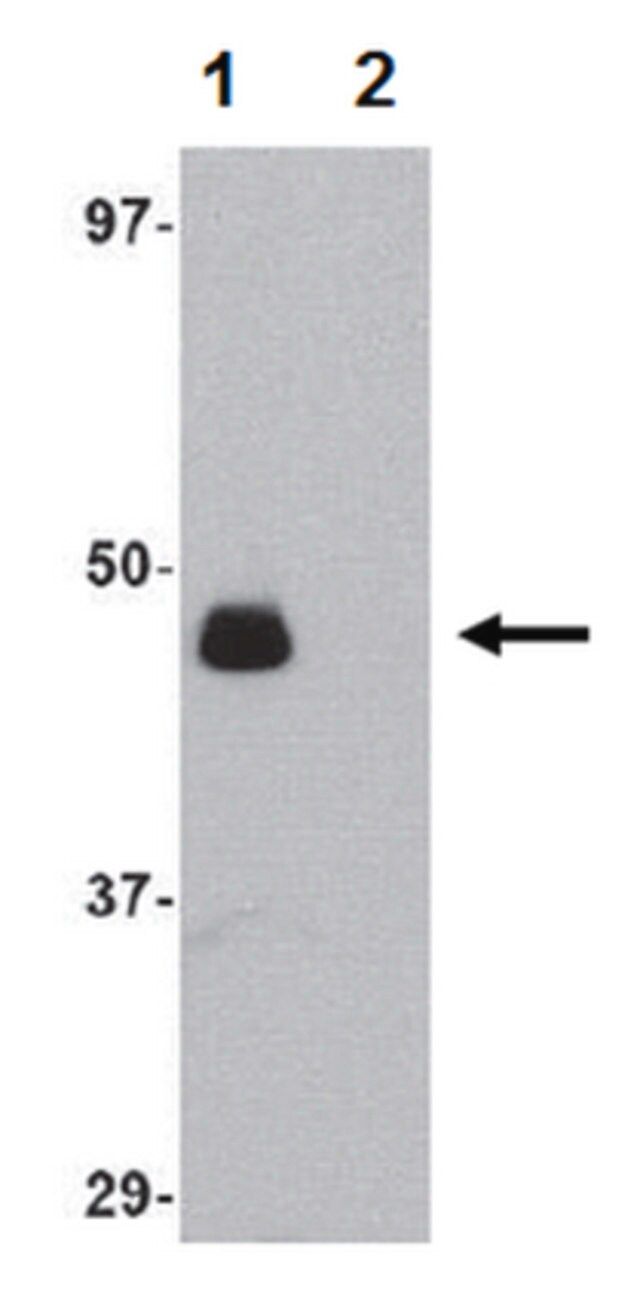 Anti-IL-34 Antibody