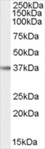 Anti-IL12B/IL12P40 (AB1) antibody produced in goat