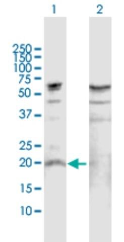 Anti-IL19 antibody produced in rabbit