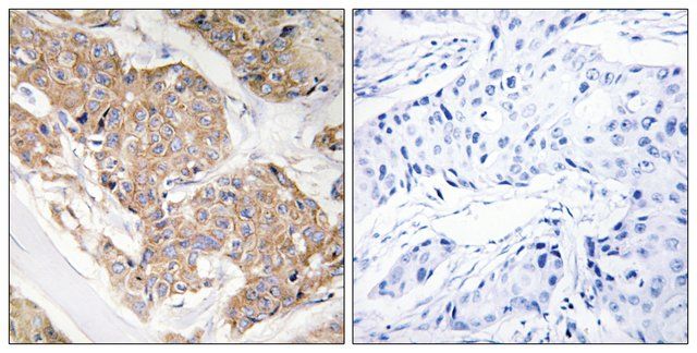 Anti-IL-13R antibody produced in rabbit