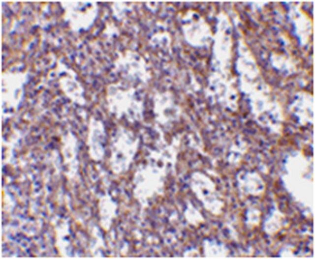 Anti-IL-32 Antibody