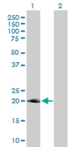 Anti-IL17D antibody produced in rabbit