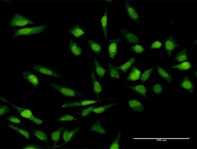 Anti-IL17C antibody produced in rabbit