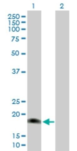 Anti-IL17E antibody produced in mouse