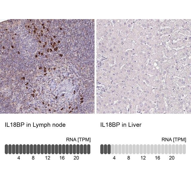 Anti-IL18BP antibody produced in rabbit