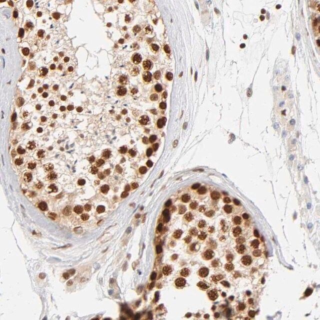 Anti-ILKAP antibody produced in rabbit