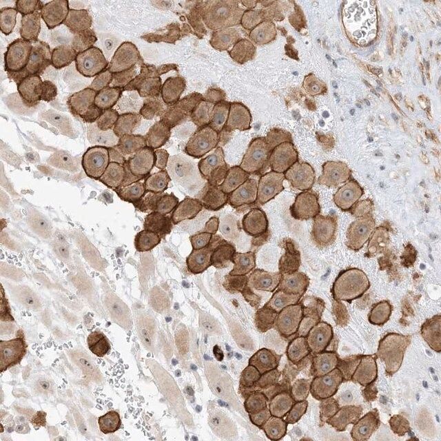 Anti-IL36B antibody produced in rabbit