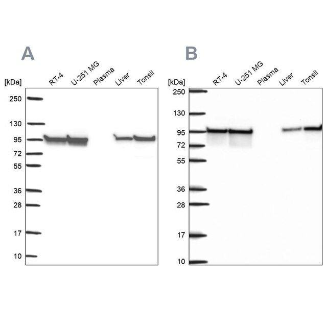 Anti-HSP90AB1 antibody produced in rabbit