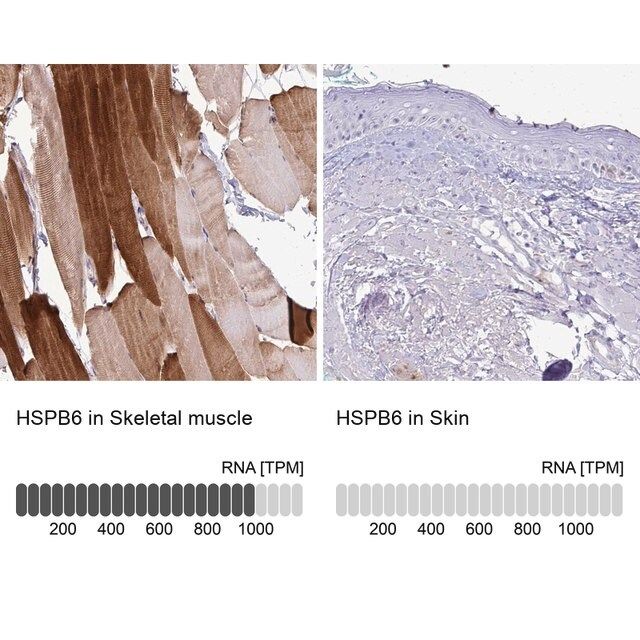 Anti-HSPB6 antibody produced in rabbit