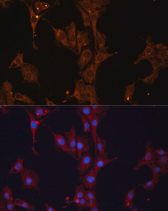 Anti-HSPB1 antibody produced in rabbit