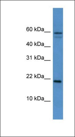 Anti-HSPB7 antibody produced in rabbit