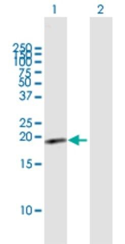 Anti-HSPC159 antibody produced in mouse