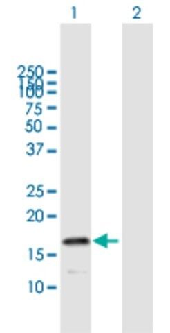 Anti-HSPB9 antibody produced in mouse