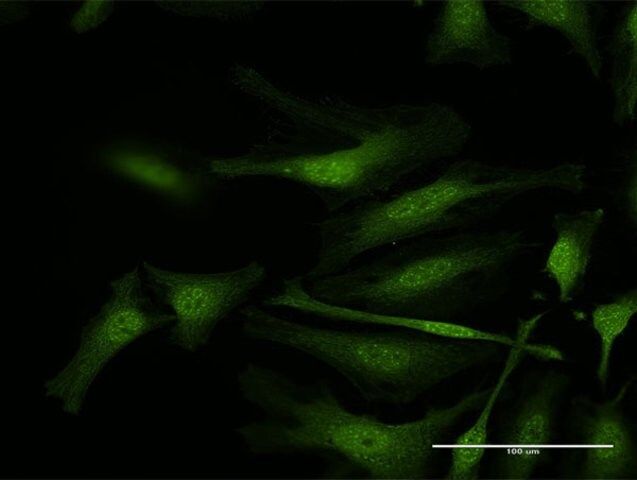 Anti-IFI35 antibody produced in rabbit