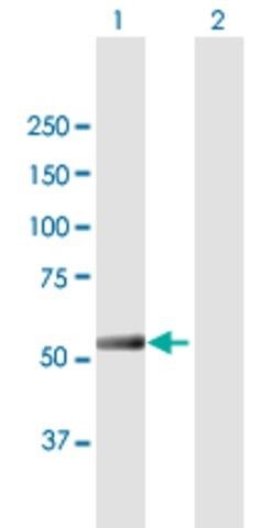 Anti-IFIT5 antibody produced in mouse