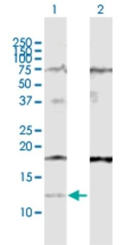 Anti-IFI27 antibody produced in rabbit