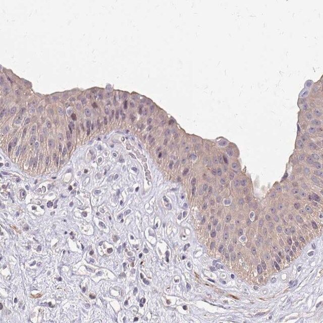 Anti-IFI44L antibody produced in rabbit