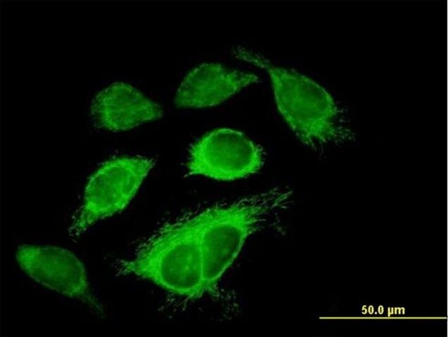 Anti-IDH3A antibody produced in mouse