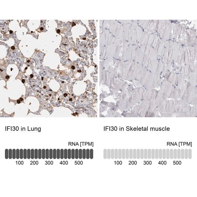 Anti-IFI30 antibody produced in rabbit