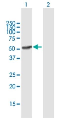 Anti-IFI44 antibody produced in mouse