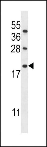 ANTI-IFI6(N-TERMINAL) antibody produced in rabbit