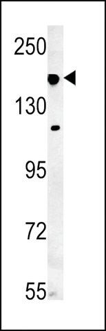 ANTI-IFT172(N-TERMINAL) antibody produced in rabbit