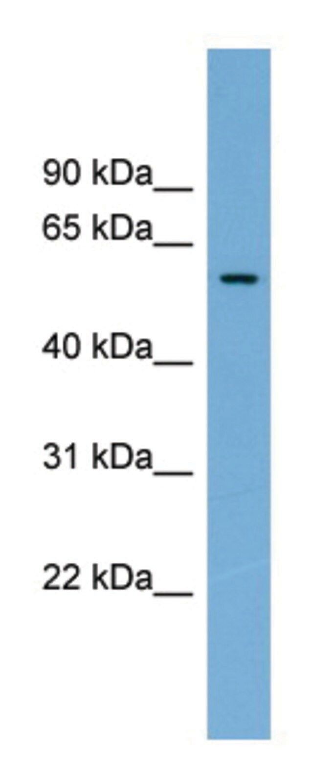 Anti-IFI44 antibody produced in rabbit