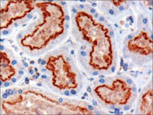 Anti-IFT88/Polaris antibody produced in goat