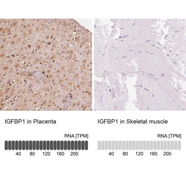 Anti-IGFBP1 antibody produced in rabbit